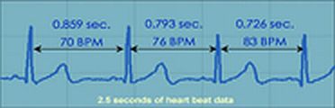How Stressed Are You? - Assess Your Stress Level with Heart Rate Variability