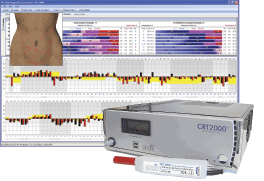 Full Body Scan for Early Detection of Disease Processes -- CRT