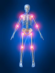 Inflammation: A Key Concept in Treating Disease & Supporting Optimal Health