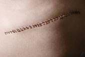 Physical trauma (injuries, surgeries, scars)